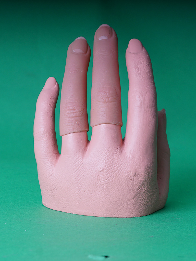 Prothèse esthétique de doigt 2